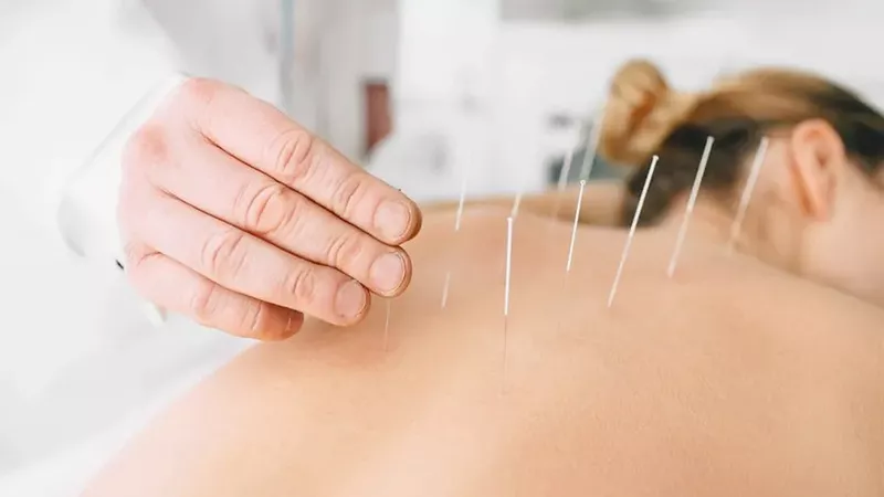 Acupuncture, The Heeler Centre, Hassocks, Sussex